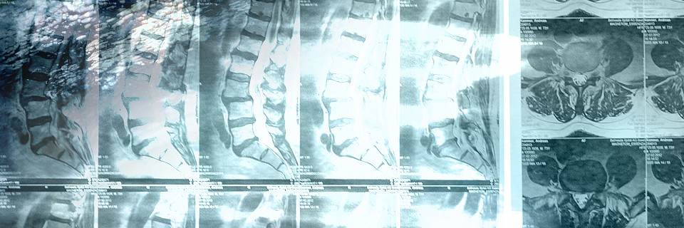 koehler neurochirurgie dissertation